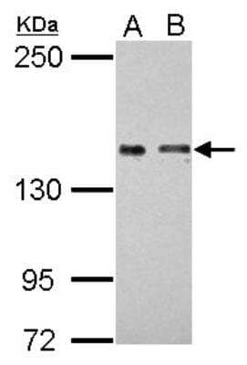 Western Blot: CL-P1/COLEC12 Antibody [NBP2-15944]