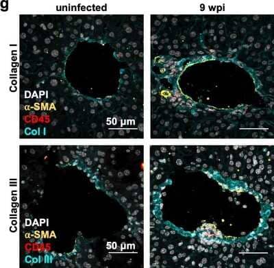 Detection of Collagen I and II in Frozen Mouse Liver