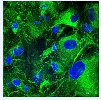 Staining of Collagen I in Human Cardiac Fibroblast Cells