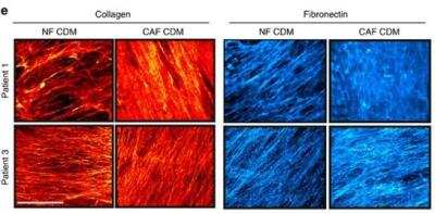 Immunohistochemical Staining of Collagen I in CAF and NF Cell-Derived Matrices