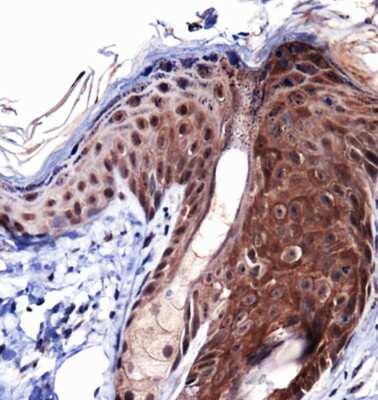 Immunohistochemistry: Collagen I alpha 1 Antibody - BSA Free [NBP1-77457]