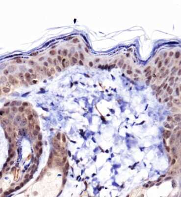 Immunohistochemistry: Collagen I alpha 1 Antibody - BSA Free [NBP1-77458]