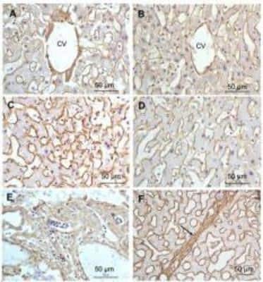 Immunohistochemical Staining of Collagen I in Paraffin Embedded Liver Tissue