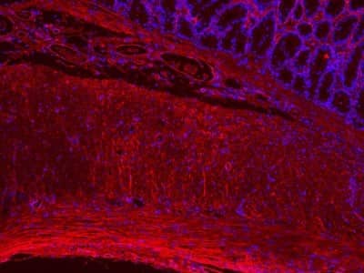 Immunohistochemical Analysis of Collagen I in Paraffin Embedded Rat Colon