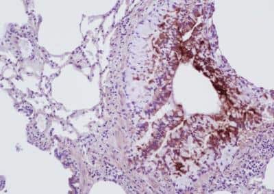 Staining of Collagen I in Rat Lung Tissue