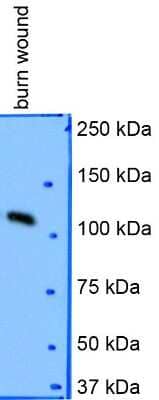 Western Blot of Collagen I in Porcine Burn Wound Lysate