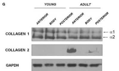 Western Blot Analysis of Collagen I and II in Young and Adult Porcine Menisci