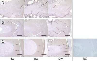 Immunohistochemistry: Collagen I alpha 1 Antibody - Azide and BSA Free [NBP1-30054]