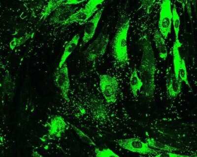 Immunocytochemistry/ Immunofluorescence: Collagen I alpha 1 Antibody (COL-1) [NB600-450]