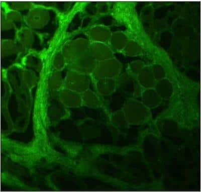 Immunohistochemistry-Frozen: Collagen I alpha 1 Antibody (COL-1) [NB600-450]