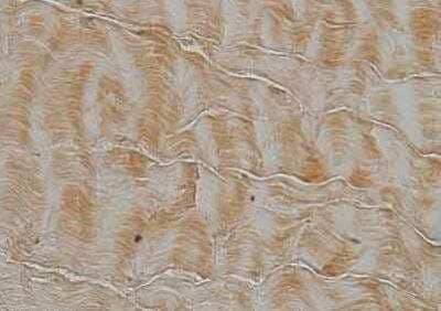 Immunohistochemistry: Collagen I alpha 1 Antibody (COL-1) [NB600-450]