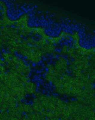Immunohistochemistry: Collagen I alpha 1 Antibody (COL-1) [NB600-450]