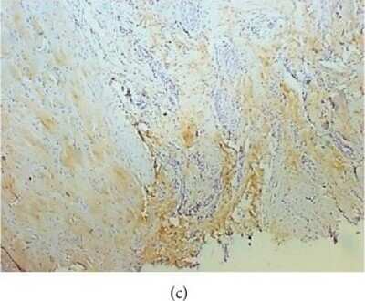 Immunohistochemistry: Collagen I alpha 1 Antibody (COL-1) [NB600-450]