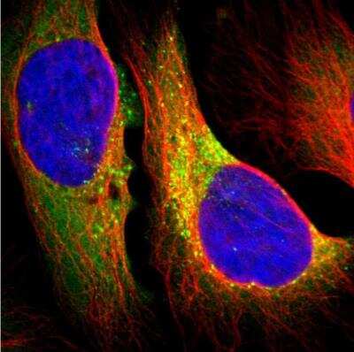 Immunocytochemistry/ Immunofluorescence: Collagen I alpha 1 Antibody [NBP1-82488]