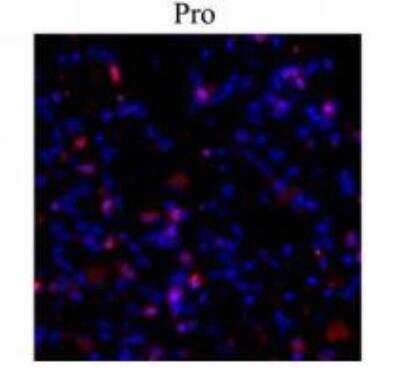 Immunohistochemistry: Collagen I alpha 1 Antibody - Azide and BSA Free [NBP2-29651]