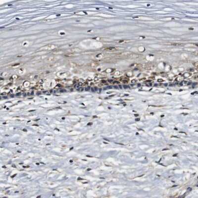 Immunohistochemistry-Paraffin: Collagen I alpha 1 Antibody [NBP1-82488]