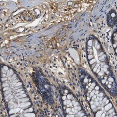Immunohistochemistry-Paraffin: Collagen I alpha 1 Antibody [NBP1-82488]