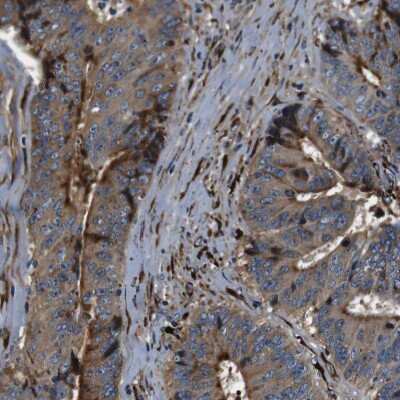 Immunohistochemistry-Paraffin: Collagen I alpha 1 Antibody [NBP1-82488]