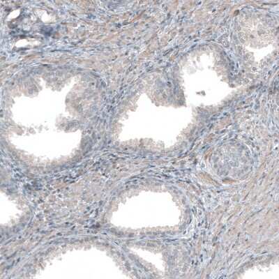 Immunohistochemistry-Paraffin: Collagen I alpha 1 Antibody [NBP1-82489]
