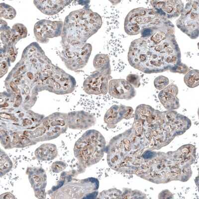 Immunohistochemistry-Paraffin: Collagen I alpha 1 Antibody [NBP1-82489]