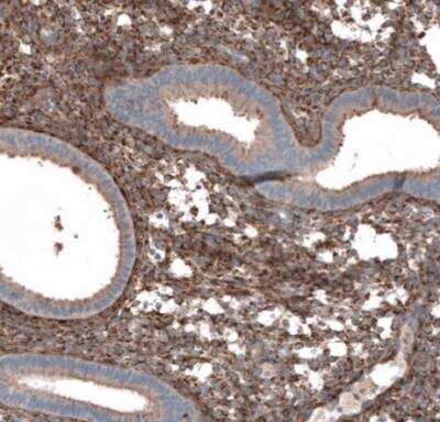 Immunohistochemistry-Paraffin: Collagen I alpha 1 Antibody [NBP1-82489]