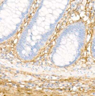 Immunohistochemistry-Paraffin: Collagen I alpha 1 Antibody - Azide and BSA Free [NBP2-92877]