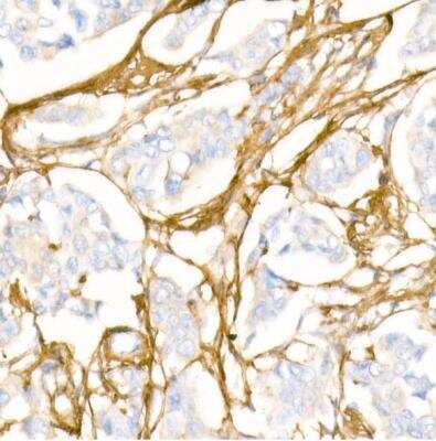 Immunohistochemistry-Paraffin: Collagen I alpha 1 Antibody - Azide and BSA Free [NBP2-92877]