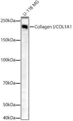 Western Blot: Collagen I alpha 1 AntibodyAzide and BSA Free [NBP2-92858]