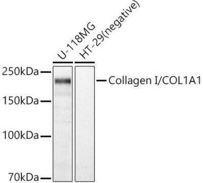 Western Blot: Collagen I alpha 1 AntibodyAzide and BSA Free [NBP2-92877]