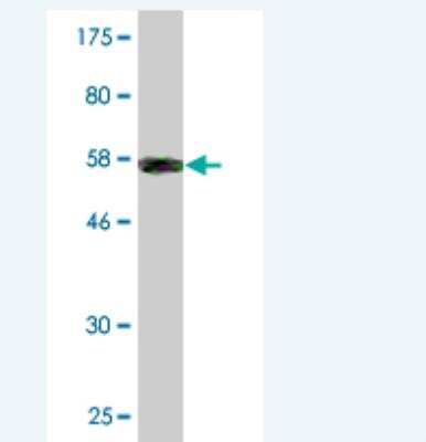 Western Blot: Collagen II Antibody (1E1) [H00001280-M06]