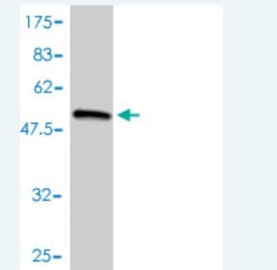 Western Blot: Collagen II Antibody (3H1-F9) [H00001280-M01]