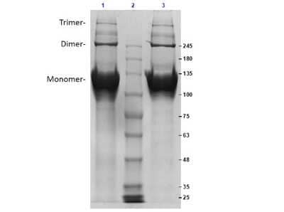 SDS-PAGE: Collagen II Native Protein [NBP1-97243]