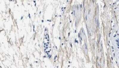 Immunohistochemistry-Paraffin: Collagen III alpha 1/COL3A1 Antibody (1E7-D7/Col3) - BSA Free [NBP1-05119]