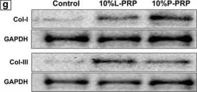 Western Blot: Collagen III alpha 1/COL3A1 Antibody (1E7-D7/Col3)BSA Free [NBP1-05119]