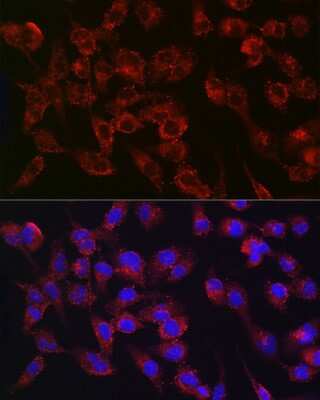 Immunocytochemistry/ Immunofluorescence: Collagen III alpha 1/COL3A1 Antibody (6Y9C6) [NBP3-15309]
