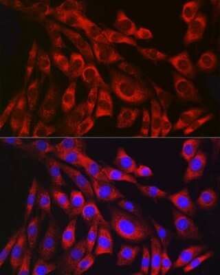 Immunocytochemistry/ Immunofluorescence: Collagen III alpha 1/COL3A1 Antibody (6Y9C6) [NBP3-15309]