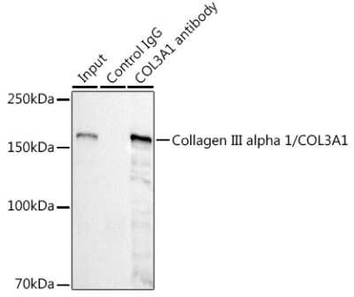 Immunoprecipitation: Collagen III alpha 1/COL3A1 Antibody (6Y9C6) [NBP3-15309]