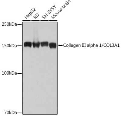 Western Blot: Collagen III alpha 1/COL3A1 Antibody (6Y9C6) [NBP3-15309]