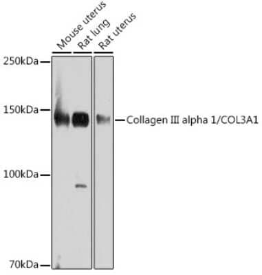 Western Blot: Collagen III alpha 1/COL3A1 Antibody (6Y9C6) [NBP3-15309]