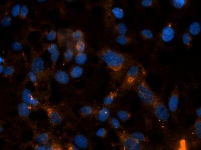 Immunocytochemistry/ Immunofluorescence: Collagen III alpha 1/COL3A1 Antibody [NB600-594]