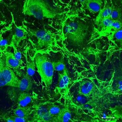 Immunocytochemistry/ Immunofluorescence: Collagen III alpha 1/COL3A1 Antibody [NB600-594]