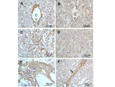 Immunohistochemistry: Collagen III alpha 1/COL3A1 Antibody [NB600-594]