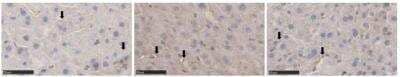 Immunohistochemistry: Collagen III alpha 1/COL3A1 Antibody [NB600-594]
