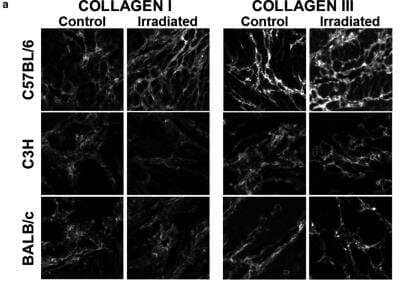 Immunohistochemistry: Collagen III alpha 1/COL3A1 Antibody [NB600-594]