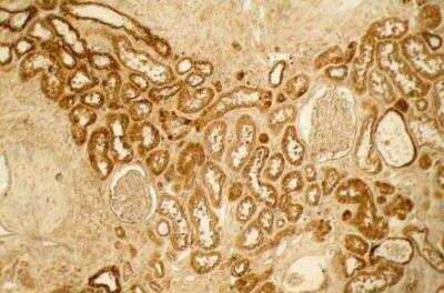 Immunohistochemistry-Paraffin: Collagen III alpha 1/COL3A1 Antibody [NB600-594]