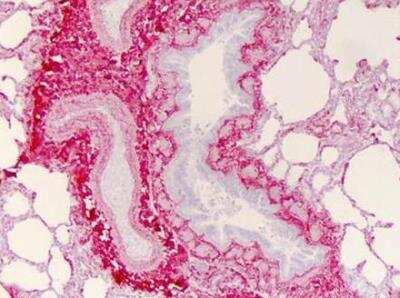 Immunohistochemistry-Paraffin: Collagen III alpha 1/COL3A1 Antibody [NB600-594]