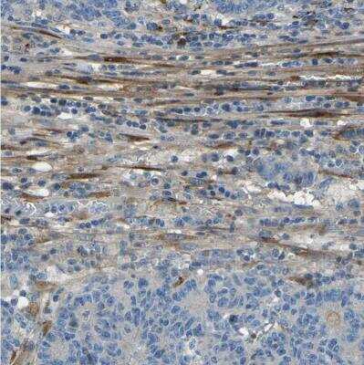Immunohistochemistry-Paraffin: Collagen III alpha 1/COL3A1 Antibody [NBP1-84007]