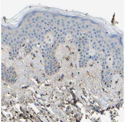 Immunohistochemistry-Paraffin: Collagen III alpha 1/COL3A1 Antibody [NBP1-84007]