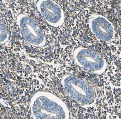 Immunohistochemistry-Paraffin: Collagen III alpha 1/COL3A1 Antibody [NBP1-84007]