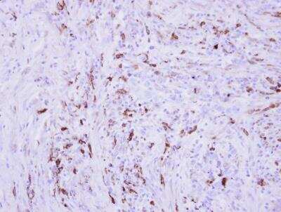 Immunohistochemistry-Paraffin: Collagen III alpha 1/COL3A1 Antibody [NBP2-15946]